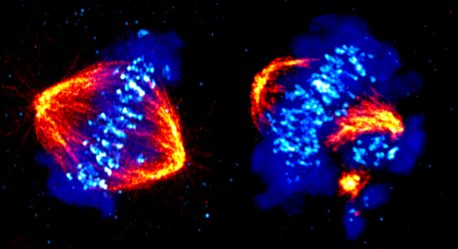 Left: The process of cell division, called mitosis, showing structures called microtubules (orange) pulling the chromosomes (blue) to opposite sides, called spindle poles, of the cell. CDK12 is critical for proper chromosome alignment and progression through mitosis. Right: Without CDK12 the chromosomes become misaligned and detach from the spindle poles.